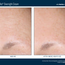 AlphaRet® Overnight Cream