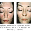 Restore Bionic Face Cream