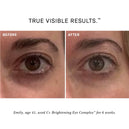 C+ Brightening Eye Complex™
