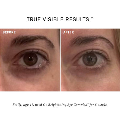 C+ Brightening Eye Complex™