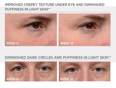 Enlighten Brightening Eye Cream