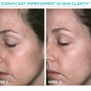 Restore PHA Facial Cleanser