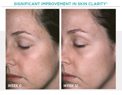 Restore PHA Facial Cleanser