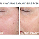 NEOSTRATA® Restore PHA Renewal Pads