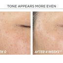 NEOSTRATA® Restore PHA Renewal Pads