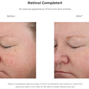 Retinol Complete® 0.5