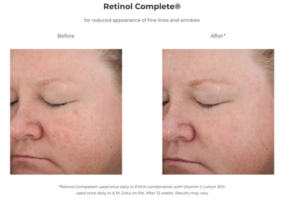 Retinol Complete® 0.5