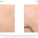 Retinol Complete® 0.5