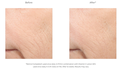 Retinol Complete® 0.5