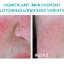 Restore Redness Neutralizing Serum