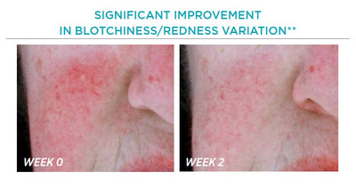 Restore Redness Neutralizing Serum