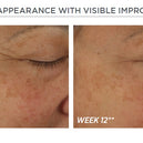 Skin Active Potent Retinol Complex 30ml
