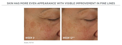 Skin Active Potent Retinol Complex 30ml