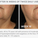 Skin Active Tri-Therapy Lifting Serum with MicroDiPeptide229®