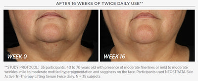 Skin Active Tri-Therapy Lifting Serum with MicroDiPeptide229®