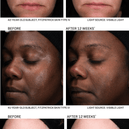 Revision Skincare® D∙E∙J Power Regimen Consumer Brochure (12 pages)