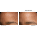 D·E·J BioStim™ Treatment Pack