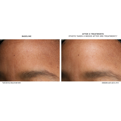 D·E·J BioStim™ Treatment Pack