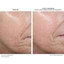 D·E·J BioStim™ Treatment Pack