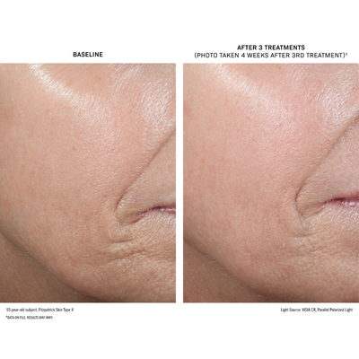 D·E·J BioStim™ Treatment Pack