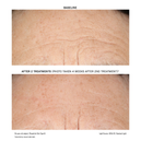 D·E·J BioStim™ Treatment Pack