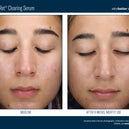 AlphaRet® Clearing Serum