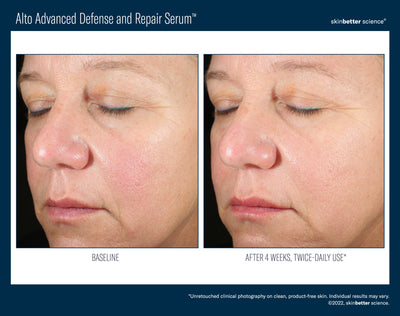Alto Advanced Defense and Repair Serum™