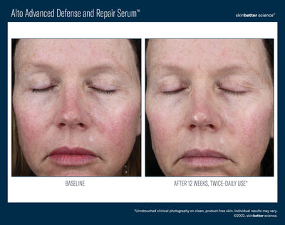 Alto Advanced Defense and Repair Serum™