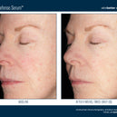 Alto Defense Serum™