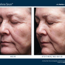 Alto Defense Serum™