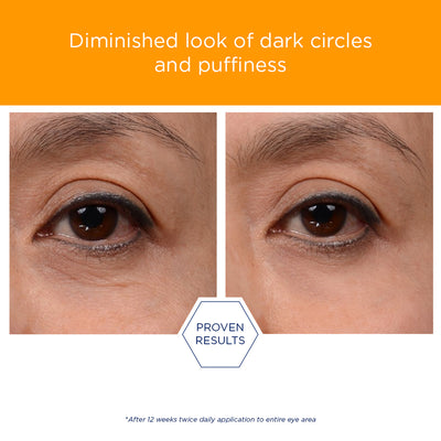 Enlighten Brightening Eye Cream