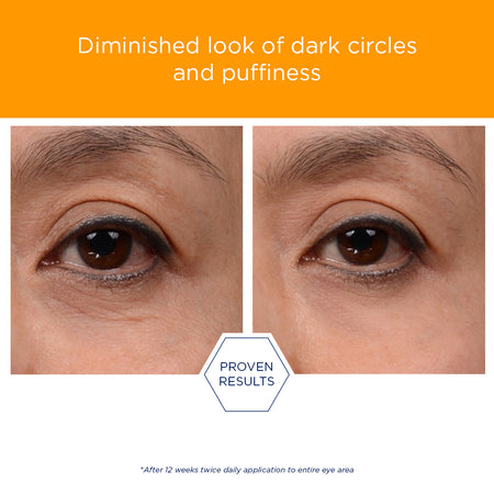 NEOSTRATA® Enlighten Brightening Eye Cream