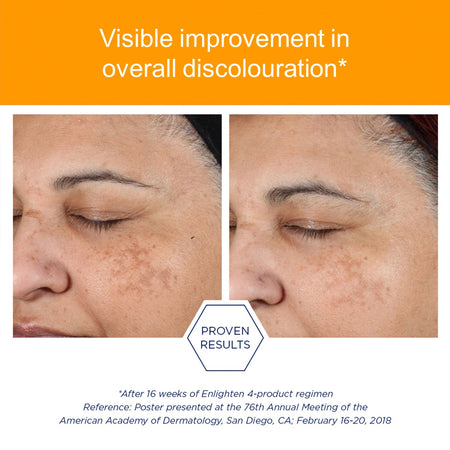 NEOSTRATA® Enlighten Ultra Brightening Cleanser
