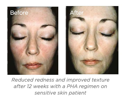 NeoStrata Prosystem Bionic Face Cream Dramming 227g – AestheticSource