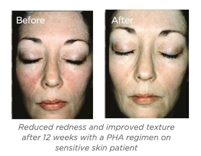 Restore Bionic Face Cream