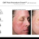 CMT Post-Procedure Cream™ - 56g