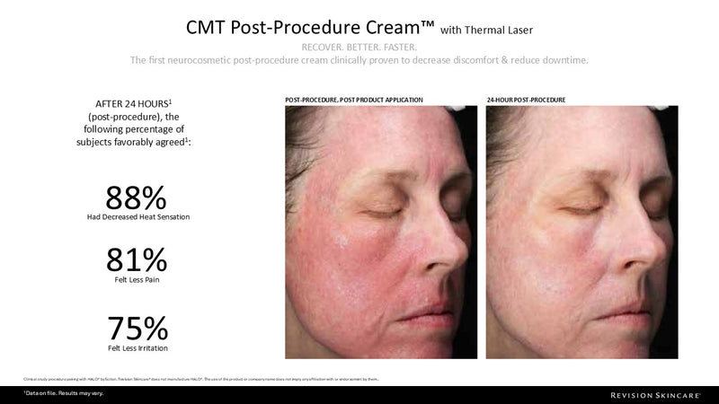 CMT Post-Procedure Cream™