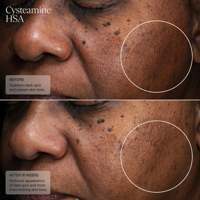 Senté Pigment & Tone Correcting Mask, Cysteamine + HSA