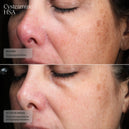 Senté Pigment & Tone Correcting Mask, Cysteamine + HSA