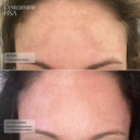 Senté Pigment & Tone Correcting Mask, Cysteamine + HSA