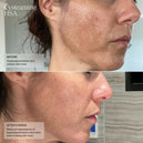 Senté Pigment & Tone Correcting Mask, Cysteamine + HSA