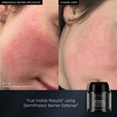 DermProtect Barrier Defense™