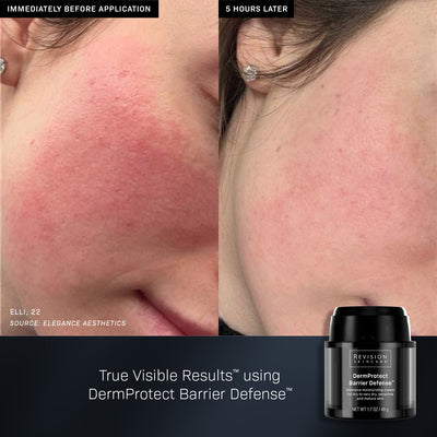 DermProtect Barrier Defense™