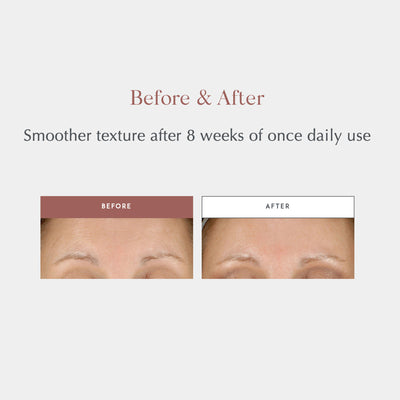 Exuviance® Daily Resurfacing Peel CA10