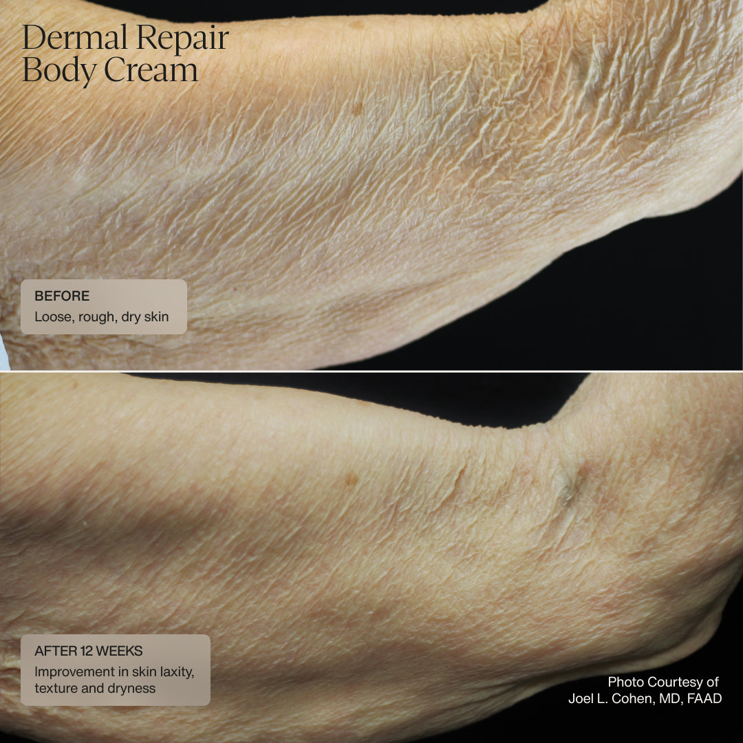 Dermal Repair Body Cream AestheticSource