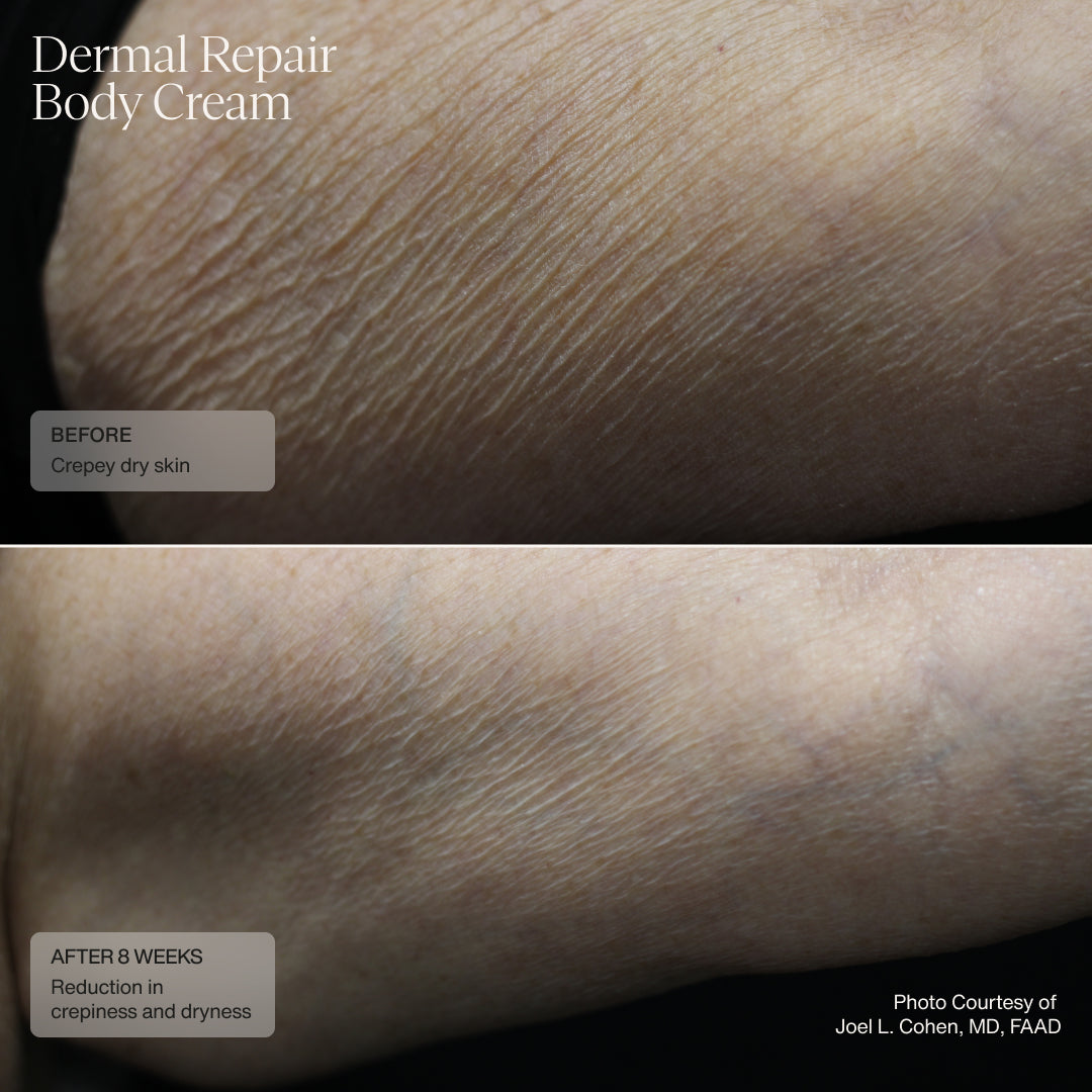 Dermal Repair Body Cream AestheticSource