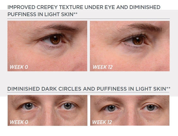 NEOSTRATA® Enlighten Brightening Eye Cream