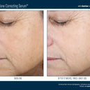 Even Tone Correcting Serum™