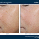 Even Tone Correcting Serum™