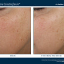Even Tone Correcting Serum™